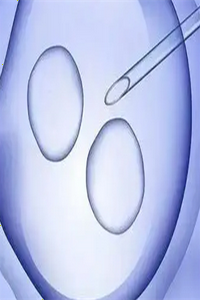 广州三代试管婴儿优