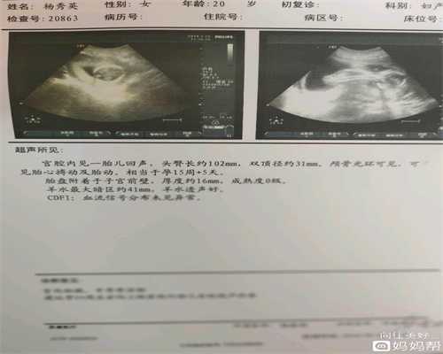 女性代孕须知 如何预防出生缺陷_刘小庆不生育的