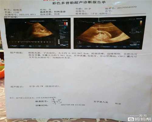 妊娠期是什么意思_上海世纪代代孕机构