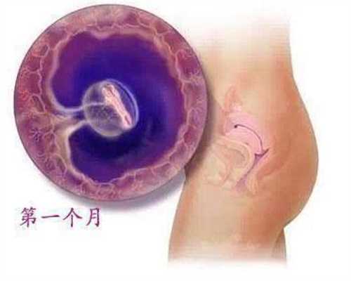 泰国生子：做了输卵管手术两个月可以代孕吗