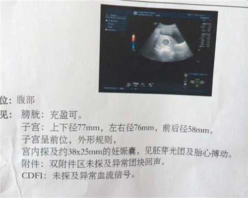 杭州供卵三代试管：来月经有血块是什么原因