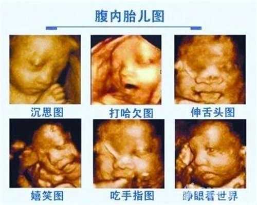 北京未婚怀孕怎么建档：精子质量差代孕几率