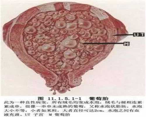 广州金贝供卵医院官网_怎么减肚子的肉肉