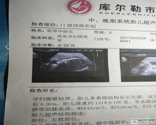 供卵母体_有偿捐卵正规医院_河北省能做三代试管婴儿的医院是哪一家？