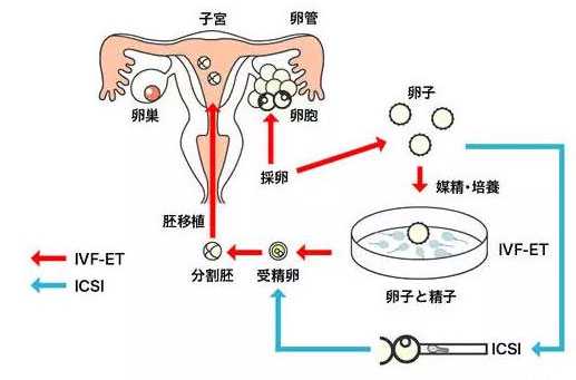 供卵试管一次多少钱_第三代试管选胚胎_贵医附院：贵州省首个“第三代试管婴