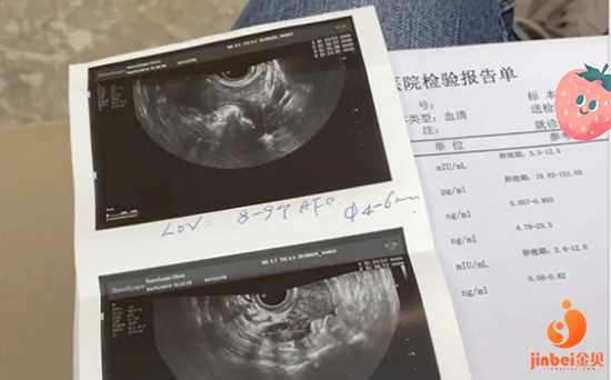 南京供卵试管医院_试管婴儿可以选择血型吗_37岁试管的亲身经历，给你们个参