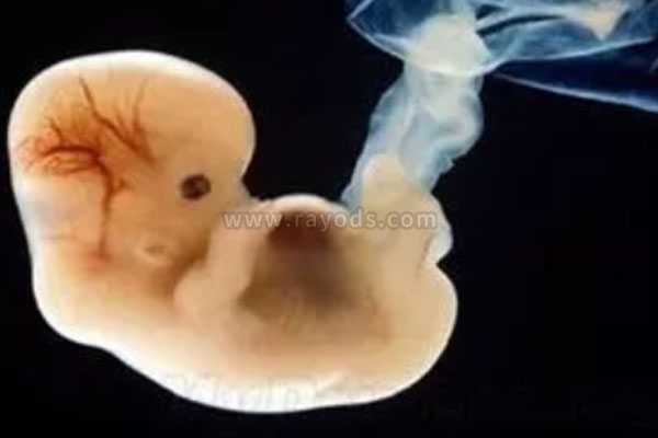 多囊卵巢三代试管失败_三代试管婴儿筛查_子宫内膜环境异常赴泰国试管婴儿，