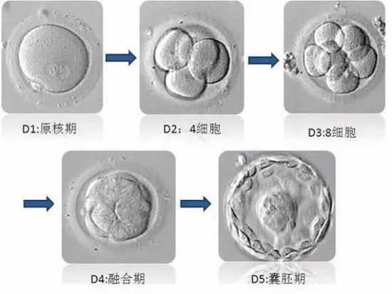 三代试管可以选择婴儿_第三代试管的价格_试管婴儿中的鲜胚、冻胚、囊胚移植