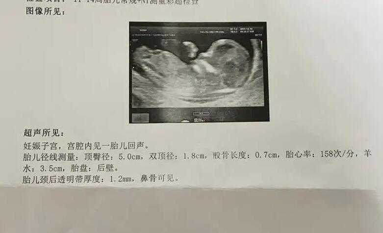 香港可以做试管婴儿选性别_试管医院有熟人可以选性别吗_年轻女性amh值低有办