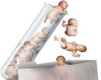泰国试管婴儿选性别合法吗_二代试管会挑选精子吗_美国试管婴儿多少钱，与国