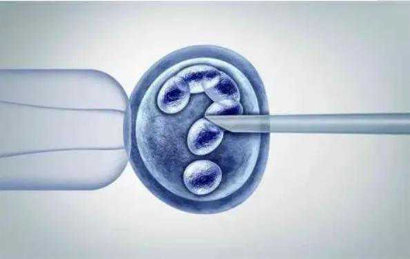 试管性别筛选对胚胎有影响吗_北京那个医院能做供卵试管_俄罗斯试管婴儿移植