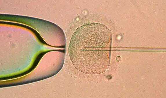 试管婴儿几代可以选男女_试管婴儿筛选性别对胚胎损伤大吗?_做试管婴儿成功率