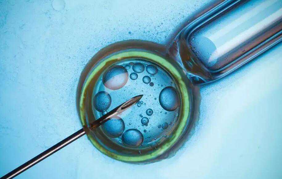 试管婴儿筛选胚胎性别都是一样的吗?_试管婴儿龙凤胎的几率有多大_江西瑞金市